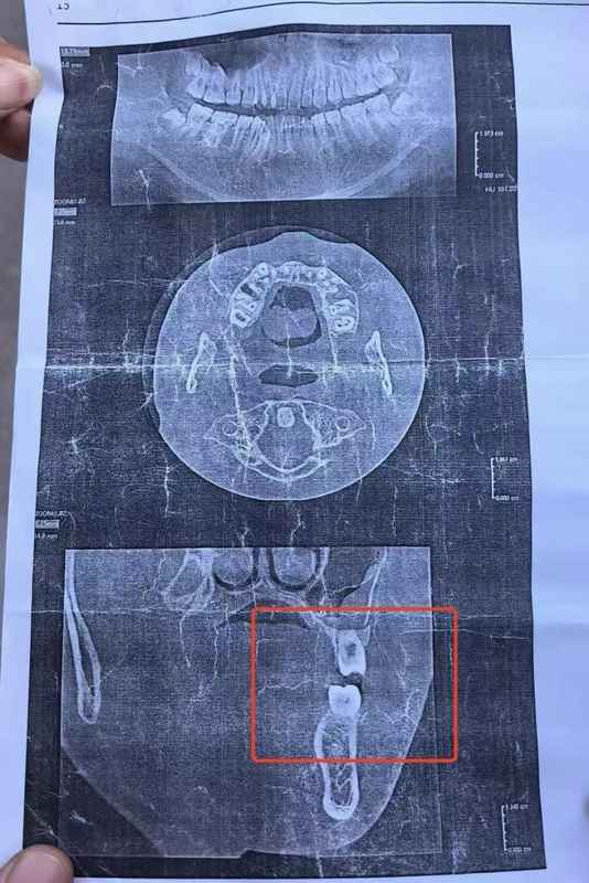  初三家长：校园突发暴力事件后的紧急应急处置方案 教育招生 初三家长：校园突发暴力事件后的紧急应急处置方案 教育招生